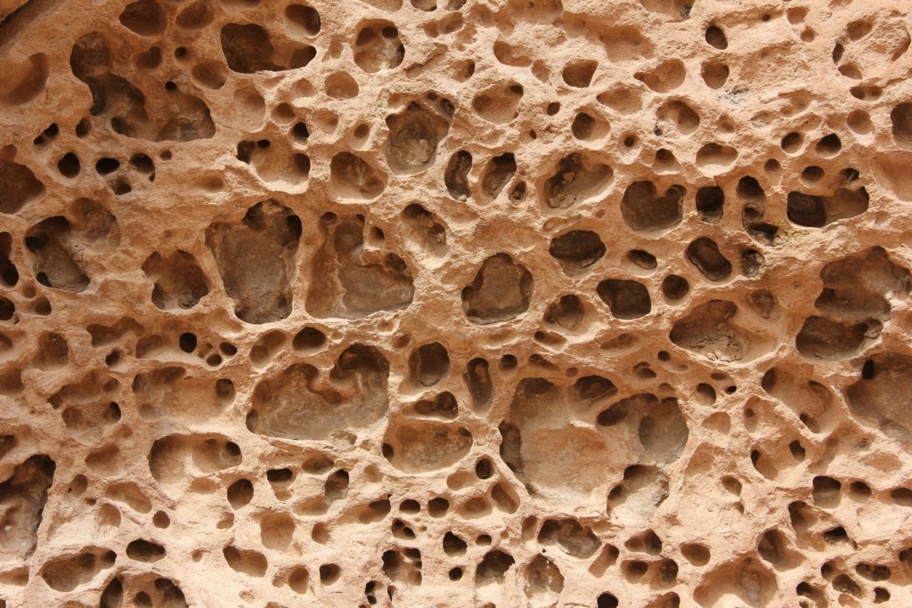 Stronger Bones, Healthier You: Understanding and Managing Osteoporosis