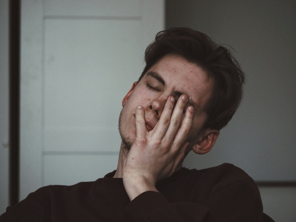 Exhausted young man rubbing his face in fatigue, illustrating the overwhelming tiredness experienced in chronic fatigue, fibromyalgia, and long COVID