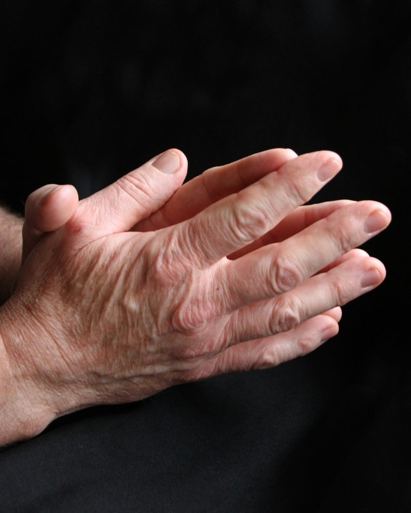  Eating Smart with Rheumatoid Arthritis: Nutrition Strategies to Support Inflammation, Pain, and Joint Health
